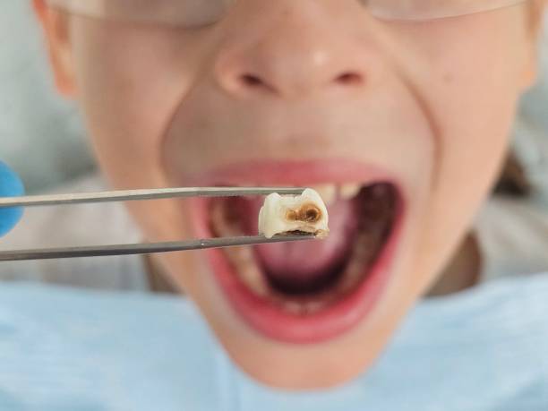 Best Walk-In Emergency Dentist in Perry, GA