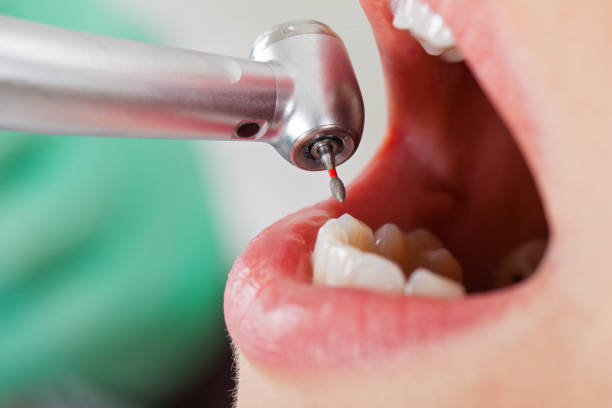 Best Emergency Dental Surgery in Perry, GA